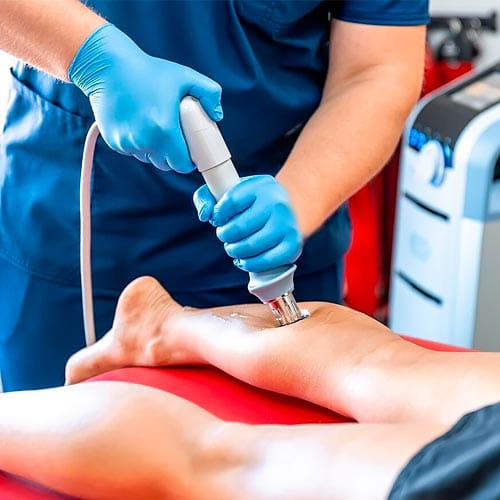 Persona recibiendo un tratamiento de ondas de choque en una pierna.